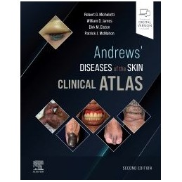 Andrews' Diseases of the...