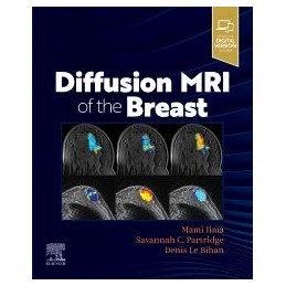 Diffusion MRI of the Breast