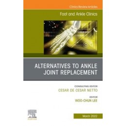 Alternatives to Ankle Joint...