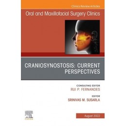 Craniosynostosis: Current Perspectives, An Issue of Oral and Maxillofacial Surgery Clinics of North America