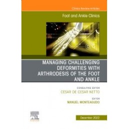 Managing Challenging deformities with arthrodesis of the foot and ankle, An issue of Foot and Ankle Clinics of North America