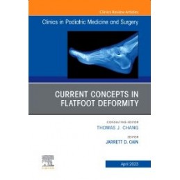 Current Concepts in Flatfoot Deformity , An Issue of Clinics in Podiatric Medicine and Surgery