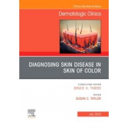 Diagnosing Skin Disease in Skin of Color, An Issue of Dermatologic Clinics