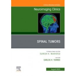 Spinal Tumors, An Issue of...