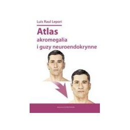 Atlas akromegalia i guzy...