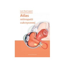 Atlas retinopatii cukrzycowej
