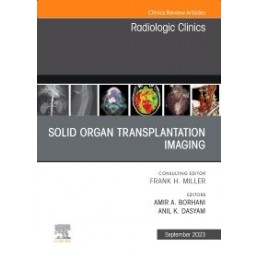 Solid organ transplantation...
