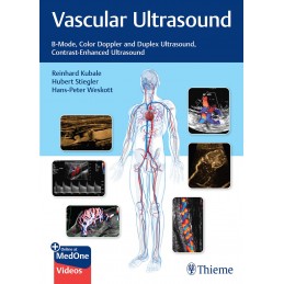 Vascular Ultrasound: B-Mode, Color Doppler and Duplex Ultrasound, Contrast-Enhanced Ultrasound